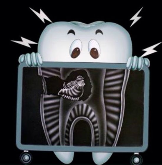 xray tooth